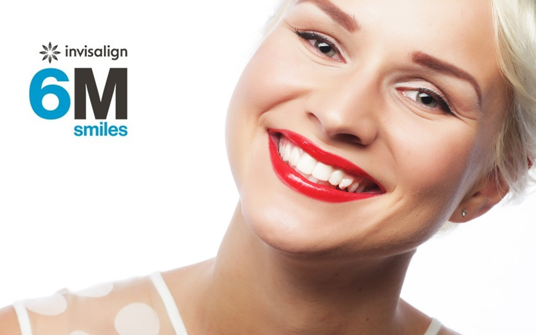 6 mln pacjentów na świecie skorzystało z metody Invisalign