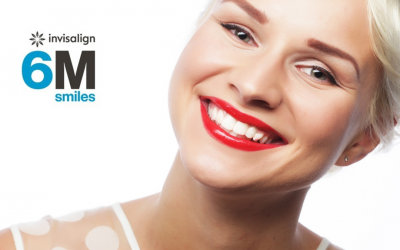 6 mln pacjentów na świecie skorzystało z metody Invisalign