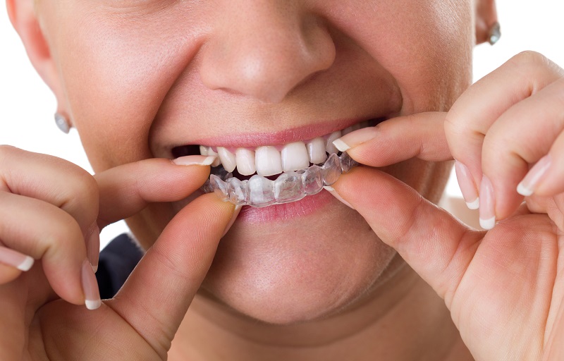 Kto pyta, nie błądzi – o co powinieneś zapytać swojego ortodontę?