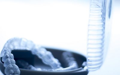 Aparat ortodontyczny – założenie aparatu ortodontycznego