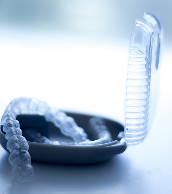 Aparat ortodontyczny – założenie aparatu ortodontycznego