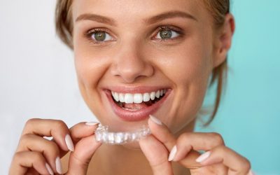 Czy leczenie aparatem Invisalign® jest drogie?