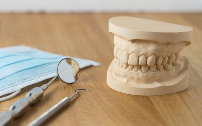 Odlew do aparatu ortodontycznego – czy powinniśmy się go obawiać?