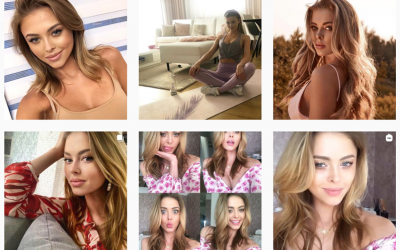 Aktorka Joanna Opozda pacjentką Kliniki Proste Zęby