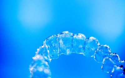 Czym są mikroimplanty ortodontyczne?