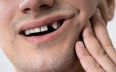 Braki w uzębieniu – czy i dlaczego mogą być groźne dla zdrowia?