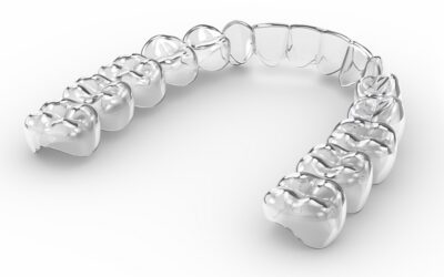 Aparat Invisalign – jak dbać o czystość nakładek i higienę jamy ustnej?