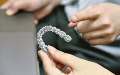 Aparat retencyjny, czyli jak utrwalić efekty leczenia ortodontycznego?