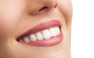 Jaki aparat ortodontyczny stały wybrać dla osoby dorosłej?