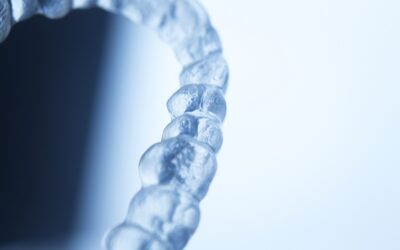 Metoda Invisalign® – po co stosujemy gumki?