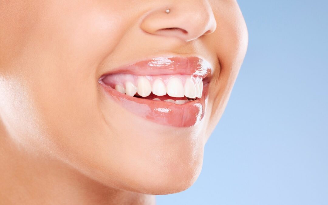 Retainer – czym jest, rodzaje i jak się stosuje?