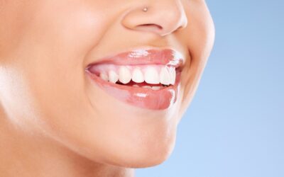 Retainer – czym jest, rodzaje i jak się stosuje?