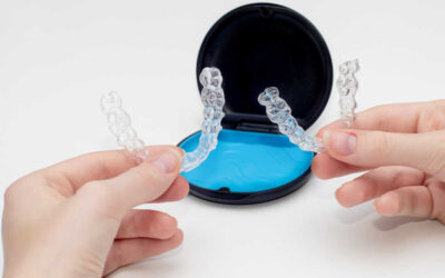 Dr Smile vs Invisalign® – podobieństwa i różnice