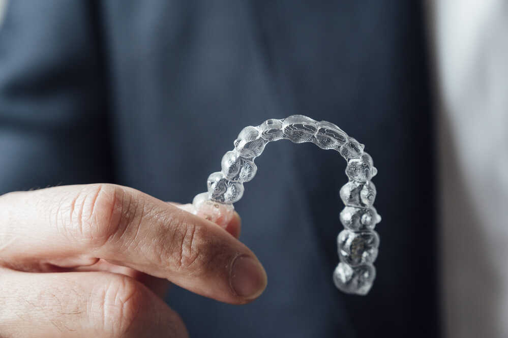 Czym są wady zgryzu i jakie są ich rodzaje?